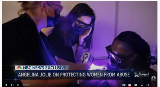 Angelina Jolie and Katherine Scafide use alternate light source to detect bruising in darker skin.